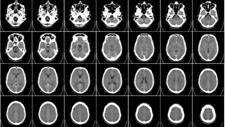 https://upload.wikimedia.org/wikipedia/commons/5/50/Computed_tomography_of_human_brain_-_large.png