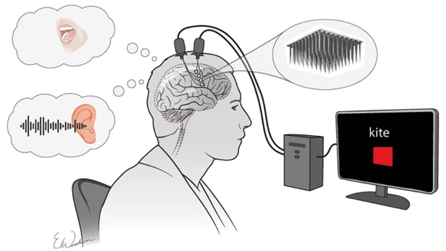 Ilustrace znázorňující mozkové implantáty, které snímají myšlenky z mozku muže a převádí je na text na monitoru.