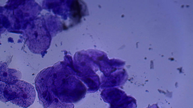 https://upload.wikimedia.org/wikipedia/commons/b/bb/Epithelial_Cells_Human_Inside_of_Mouth%2C_Stained_Microscope_Slide_2.jpg